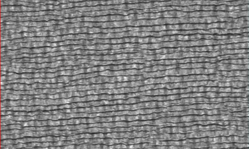 OpTiMaq Creases & Macro-fold Detection in Tissue