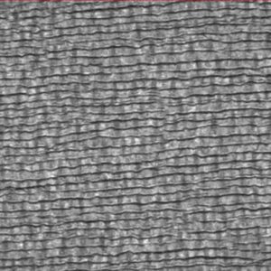 OpTiMaq (OpTiMaq Creases & Macro-fold Detection in Tissue)